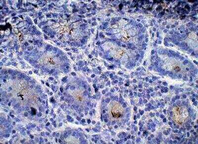 ENPP-2/Autotaxin Antibody