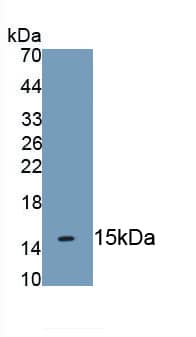 Cytokeratin 2 Antibody (D8)