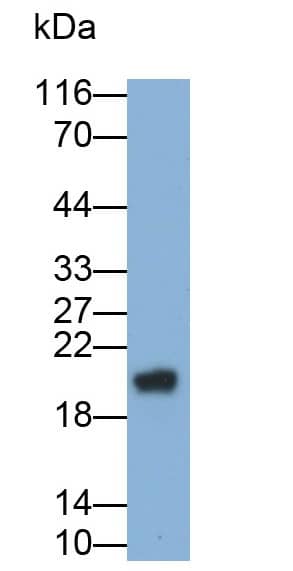 GGT1 Antibody (13#)