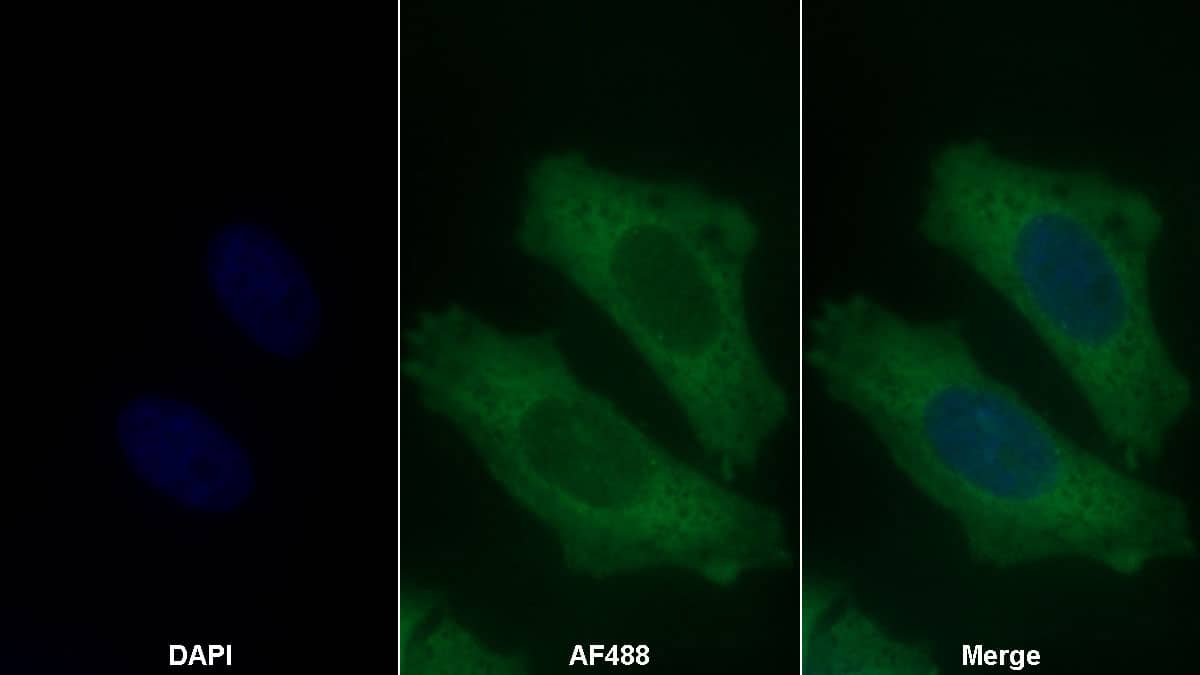 Lipolysis Stimulated Lipoprotein Receptor Antibody (D7)