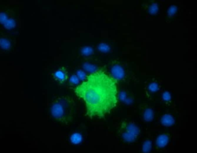PEX5 Antibody (OTI6C4)