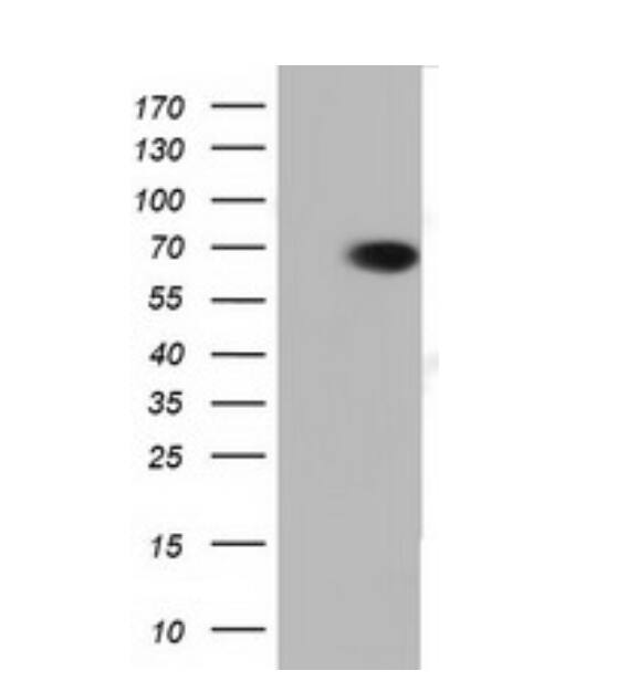 PEX5 Antibody (OTI6C4)