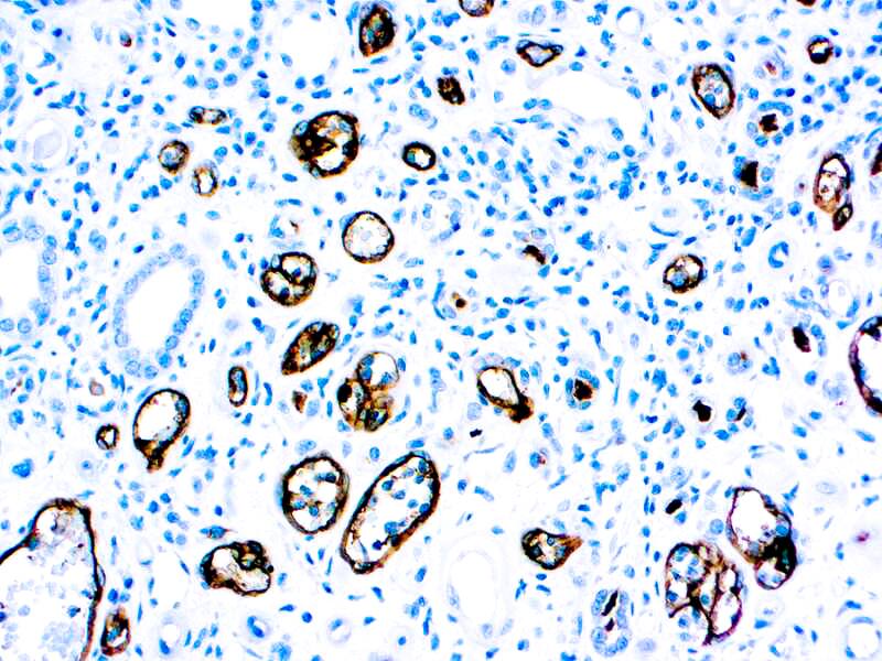 Complement C4d Antibody (C4D204)