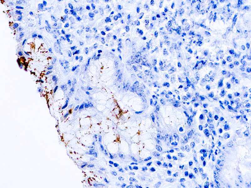 Helicobacter Pylori Antibody (DBM15.75)