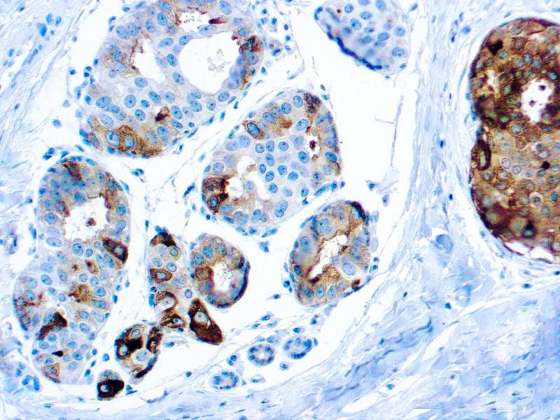 PIP Antibody (DBM15.52)