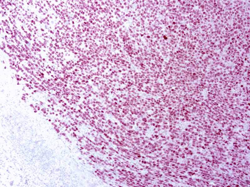 PRAME Antibody (EPR20330)