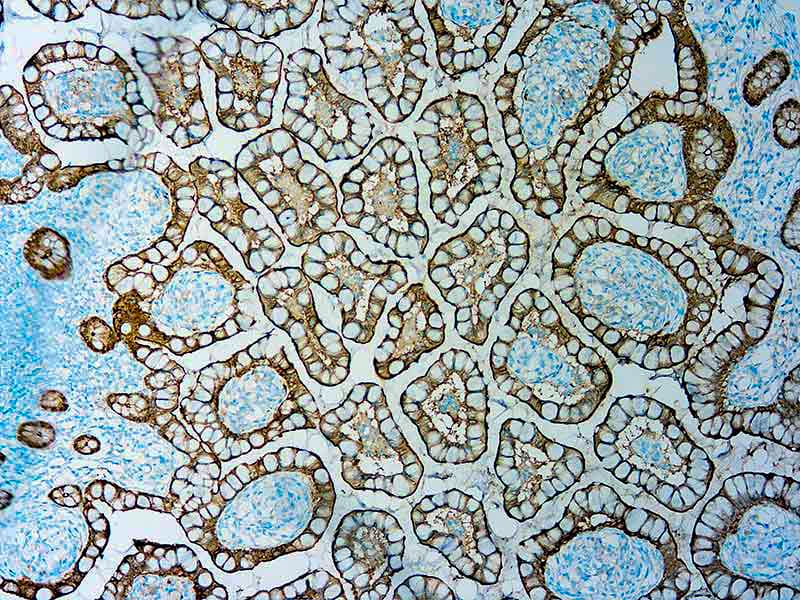 Villin 1 Antibody (1D2C3)