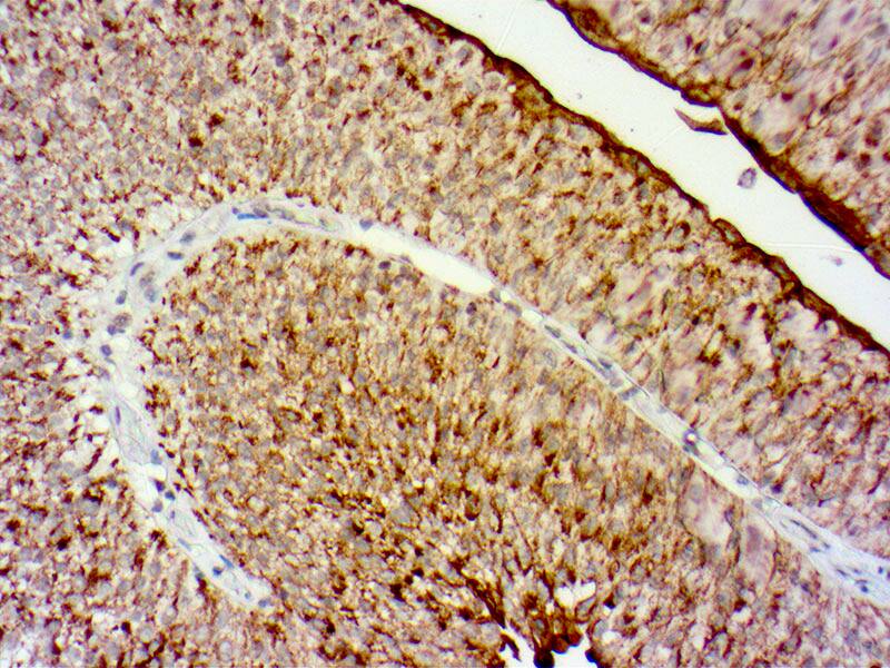 Uroplakin II Antibody