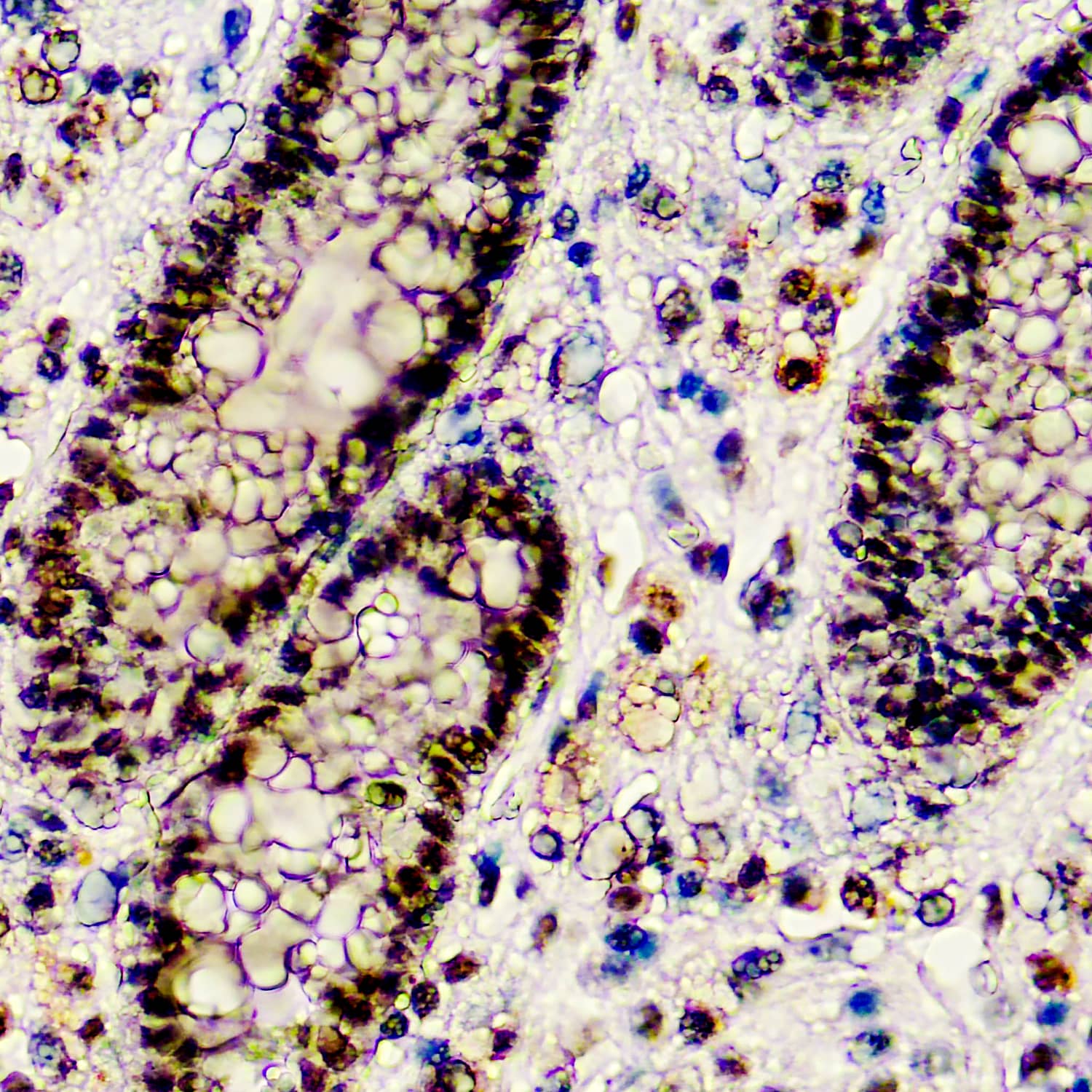 BAP1 Antibody (BAP1/2667)