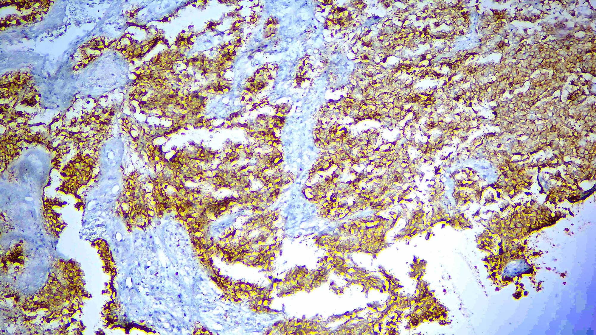 Claudin-18.2 Antibody (DBRRM1.82)