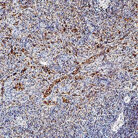 CD39/ENTPD1 Antibody (A1) CD39/ENTPD1 Antibody (A1) Detection of CD39 in Human Spleen.