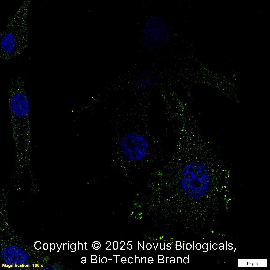 STEAP1 Antibody