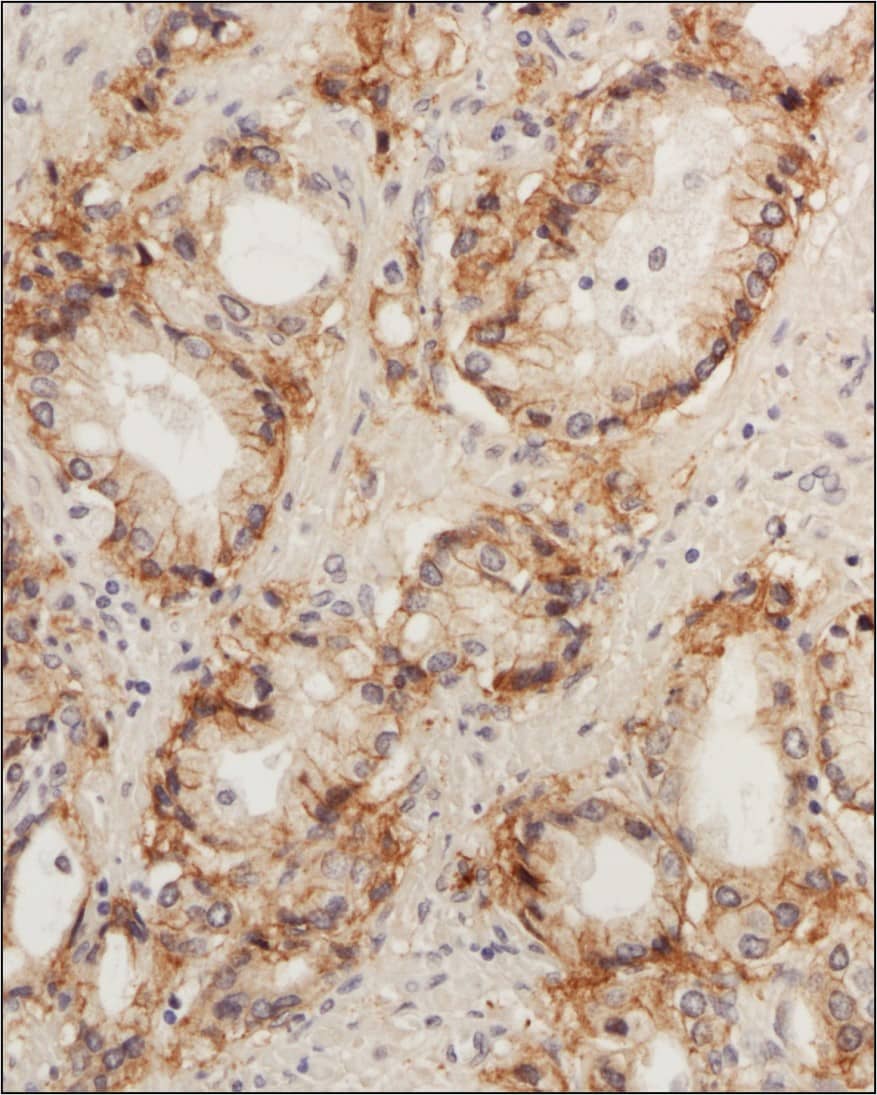 STEAP1 Antibody Immunohistochemical Staining of STEAP1 in Human Prostate