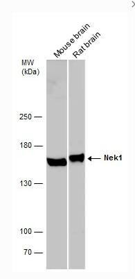 NEK1 Antibody