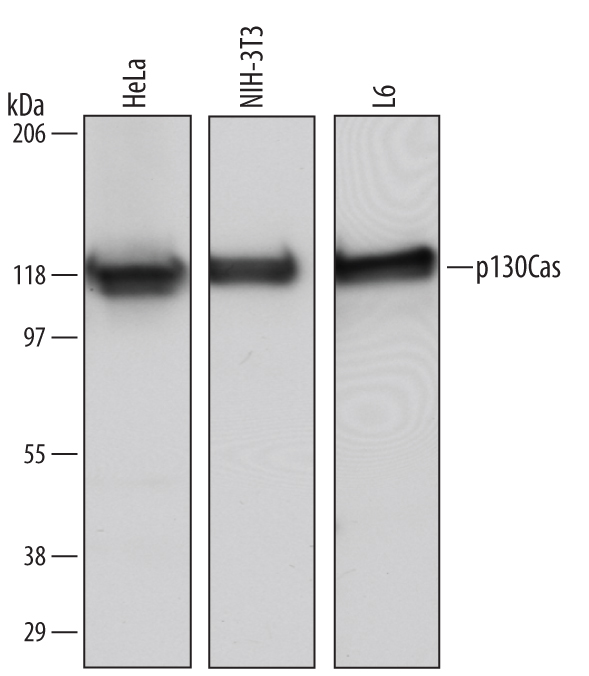 Detection of Human/Mouse/Rat p130Cas antibody by Western Blot.