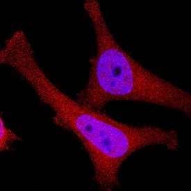p16INK4a / CDKN2A antibody in HeLa Human Cell Line by Immunocytochemistry (ICC).