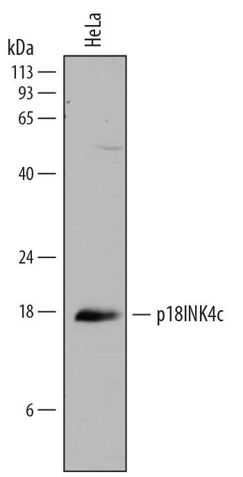 Detection of Human p18INK4c/CDKN2C antibody by Western Blot.