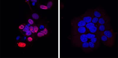 p21/CIP1/CDKN1A antibody in MCF-7 Human Cell Line by Immunocytochemistry (ICC).
