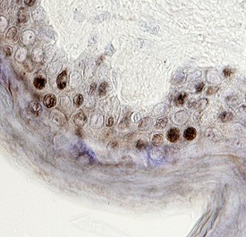 p38d antibody in Human Skin by Immunohistochemistry (IHC-P).