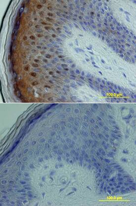 p38d antibody in Human Skin by Immunohistochemistry (IHC-P).