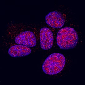 p38? antibody in MCF-7 Human Cell Line by Immunocytochemistry (ICC).