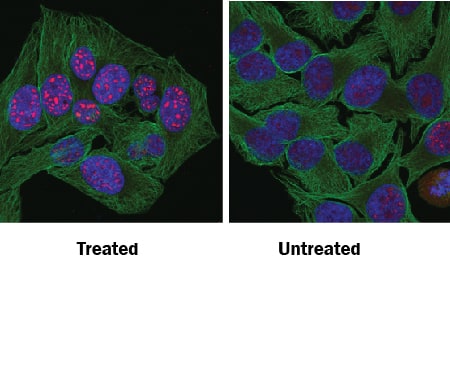 Phospho-p53 (S15) antibody in HeLa Human Cell Line by Immunocytochemistry (ICC).