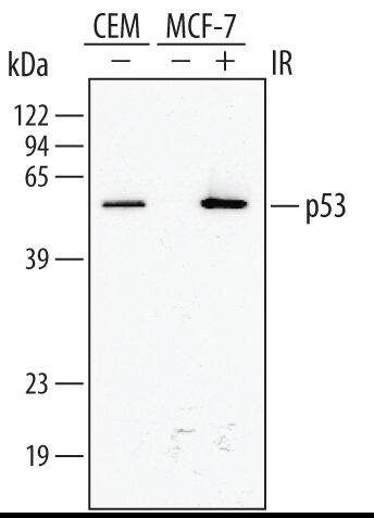 Detection of Human p53 antibody by Western Blot.