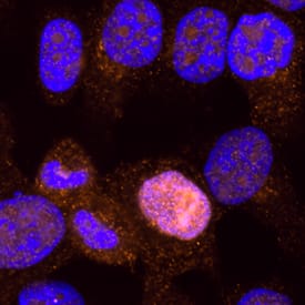 p53 antibody in HeLa Human Cell Line by Immunocytochemistry (ICC).