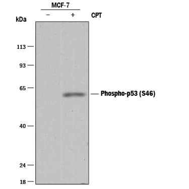 Detection of Human Phospho-p53 (S46) antibody by Western Blot.