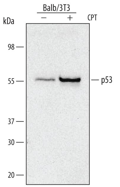 Immunoprecipitation of Mouse p53.