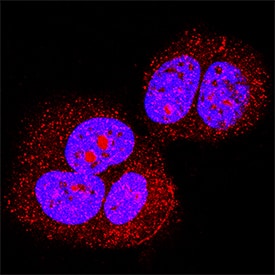 Phospho-p53 (S392) antibody in MCF-7 Human Cell Line by Immunocytochemistry (ICC).
