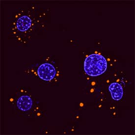 p62/SQSTM1 antibody in RAW 264 by Immunocytochemistry (ICC).7 Mouse Cell Line by Immunocytochemistry (ICC).