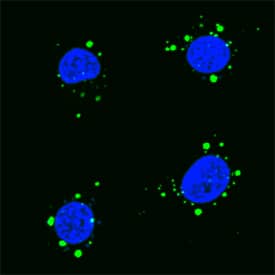 p62/SQSTM1 antibody in RAW 264 by Immunocytochemistry (ICC).7 Mouse Cell Line by Immunocytochemistry (ICC).