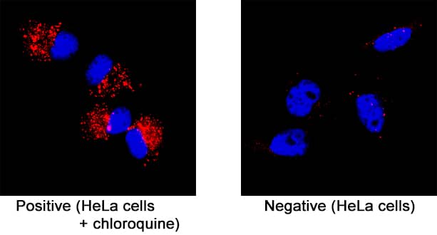 p62/SQSTM1 antibody in HeLa Human Cell Line by Immunocytochemistry (ICC).