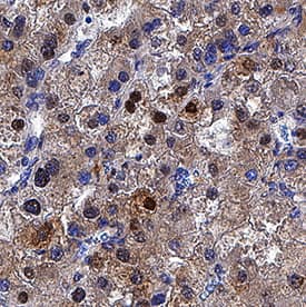 p62/SQSTM1 antibody in Human Liver by Immunohistochemistry (IHC-P).