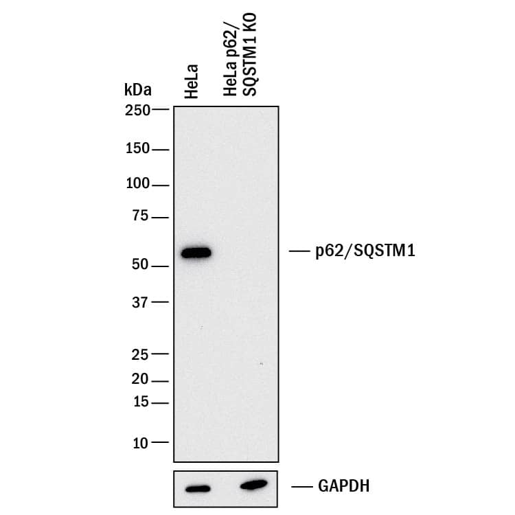 Western Blot Shows Human p62/SQSTM1 Antibody Specificity by Using Knockout Cell Line.