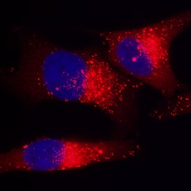 p62/SQSTM1 antibody in HeLa Human Cell Line by Immunocytochemistry (ICC).