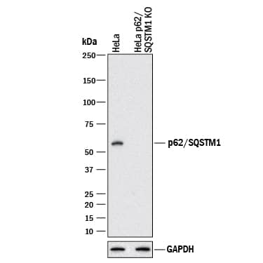 Western Blot Shows Human p62/SQSTM1 Antibody Specificity Using Knockout Cell Line.