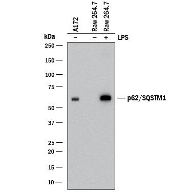 Detection of Human and Mouse p62/SQSTM1 antibody by Western Blot.