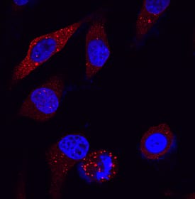 p62/SQSTM1 antibody in HeLa Human Cell Line by Immunocytochemistry (ICC).