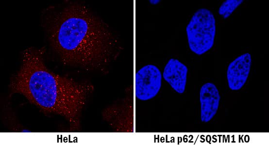 p62/SQSTM1 Antibody Specificity is Shown by Immunocytochemistry antibody in Knockout Cell Line.