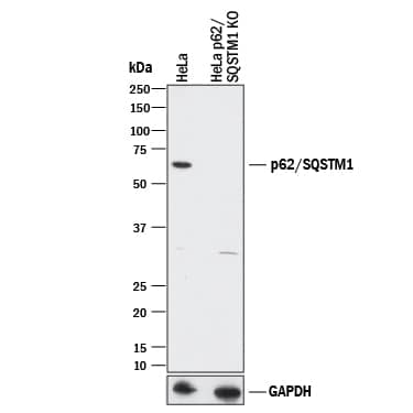 Western Blot Shows Human p62/SQSTM1 Antibody Specificity Using Knockout Cell Line.