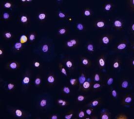 p63/TP73L antibody in SCC-25 Human Cell Line by Immunocytochemistry (ICC).