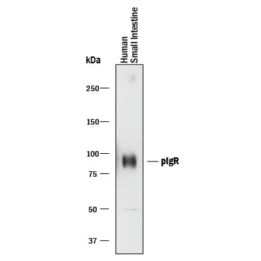 Detection of Human pIgR antibody by Western Blot.