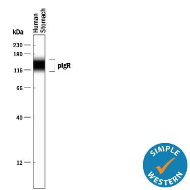 Detection of Human pIgR antibody by Simple WesternTM.