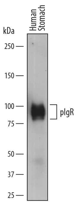 Detection of Human pIgR antibody by Western Blot.