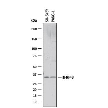 Detection of Human sFRP-3 antibody by Western Blot.