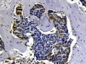 u-Plasminogen Activator (uPA)/Urokinase antibody in Human Breast Cancer Tissue by Immunohistochemistry (IHC-P).