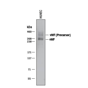 Detection of Human vWF-A2 antibody by Western Blot.