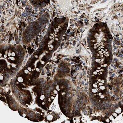 Immunohistochemistry-Paraffin: archaemetzincin-1 Antibody [NBP1-91677]